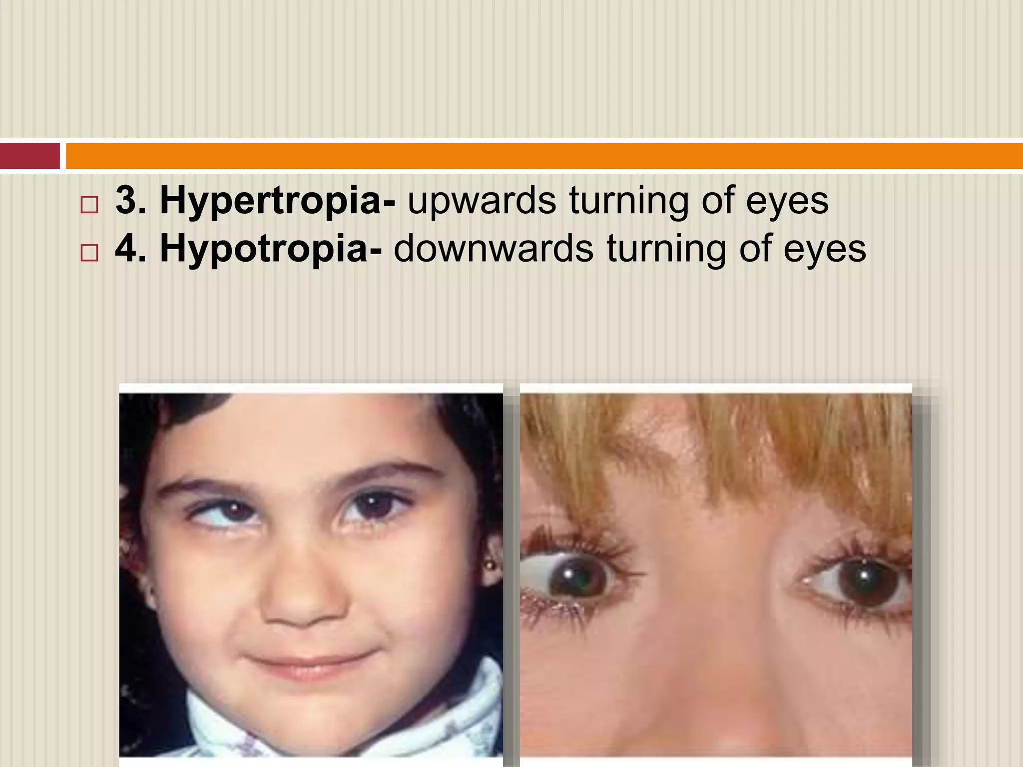 Evaluation of squint