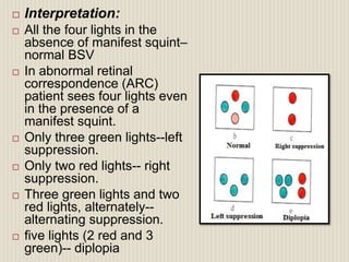 Visual Squint Evaluation of squint | PPTX