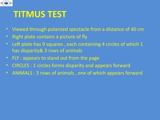 Timus Test EVALUATION OF SQUINT . MOTOR AND SENSORY EXAMINATION | PPTX