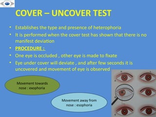 EVALUATION OF SQUINT . MOTOR AND SENSORY EXAMINATION | PPTX
