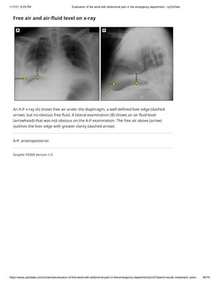 Abdominal pain in the emergency department | PDF