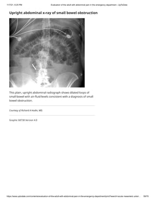 Abdominal pain in the emergency department | PDF