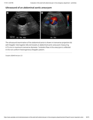 Abdominal pain in the emergency department