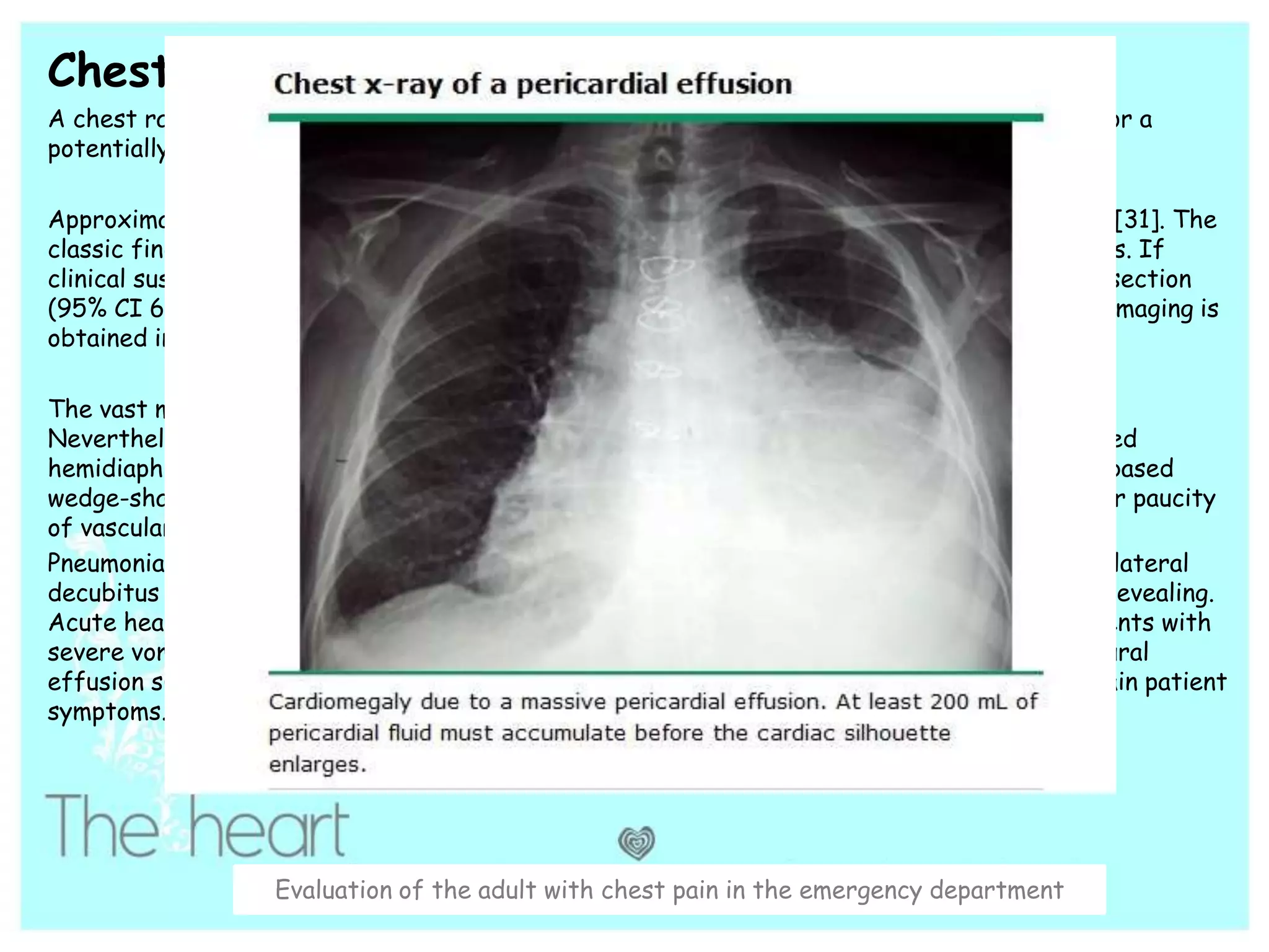 Patient Chest Evaluation of the adult chest pain in emergency department | PPTX