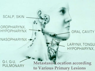 Metastasis Location according
to Various Primary Lesions
 