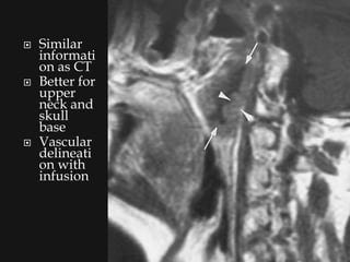    Similar
    informati
    on as CT
   Better for
    upper
    neck and
    skull
    base
   Vascular
    delineati
    on with
    infusion
 