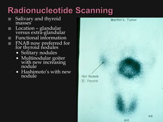    Salivary and thyroid
    masses
   Location – glandular
    versus extra-glandular
   Functional information
   FNAB now preferred for
    for thyroid nodules
     Solitary nodules
     Multinodular goiter
       with new increasing
       nodule
     Hashimoto’s with new
       nodule
 