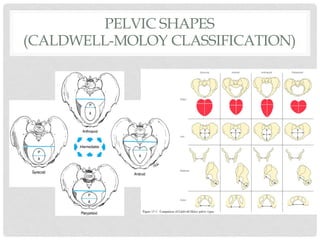 PELVIC SHAPES
(CALDWELL-MOLOY CLASSIFICATION)
Maternal Anatomy and Physiology
Corton MM: Anatomy of the pelvis: how the pelvis is built for support. Clin
FIGURE 2-20 The four parent pelvic types of the Caldwell–Moloy classification. A line passing through the widest transverse diameter
divides the inlets into posterior (P) and anterior (A) segments.
 