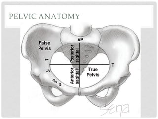 PELVIC ANATOMY
32 Maternal Anatomy and Physiology
outle
to ro
force
the d
mob
ver o
a cas
have
ting
squa
the p
obser
birth
■ P
TTTT
APAPAPAP
True
Pelvis
FFFaFaFaFallslslsseee
PPPPellele viiv sss
PPPPPPPPPososssososossososotetetetetettriiiririiirirrrorrororrorooo
sasaasasaasaaasasgigigigiigggttttttttttttalalalaa
Anterior
sagittttttttttttttlalalalalalaaaaa
 