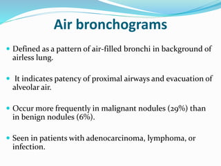 Evaluation of the solitary pulmonary nodule (radiographics) | PPTX