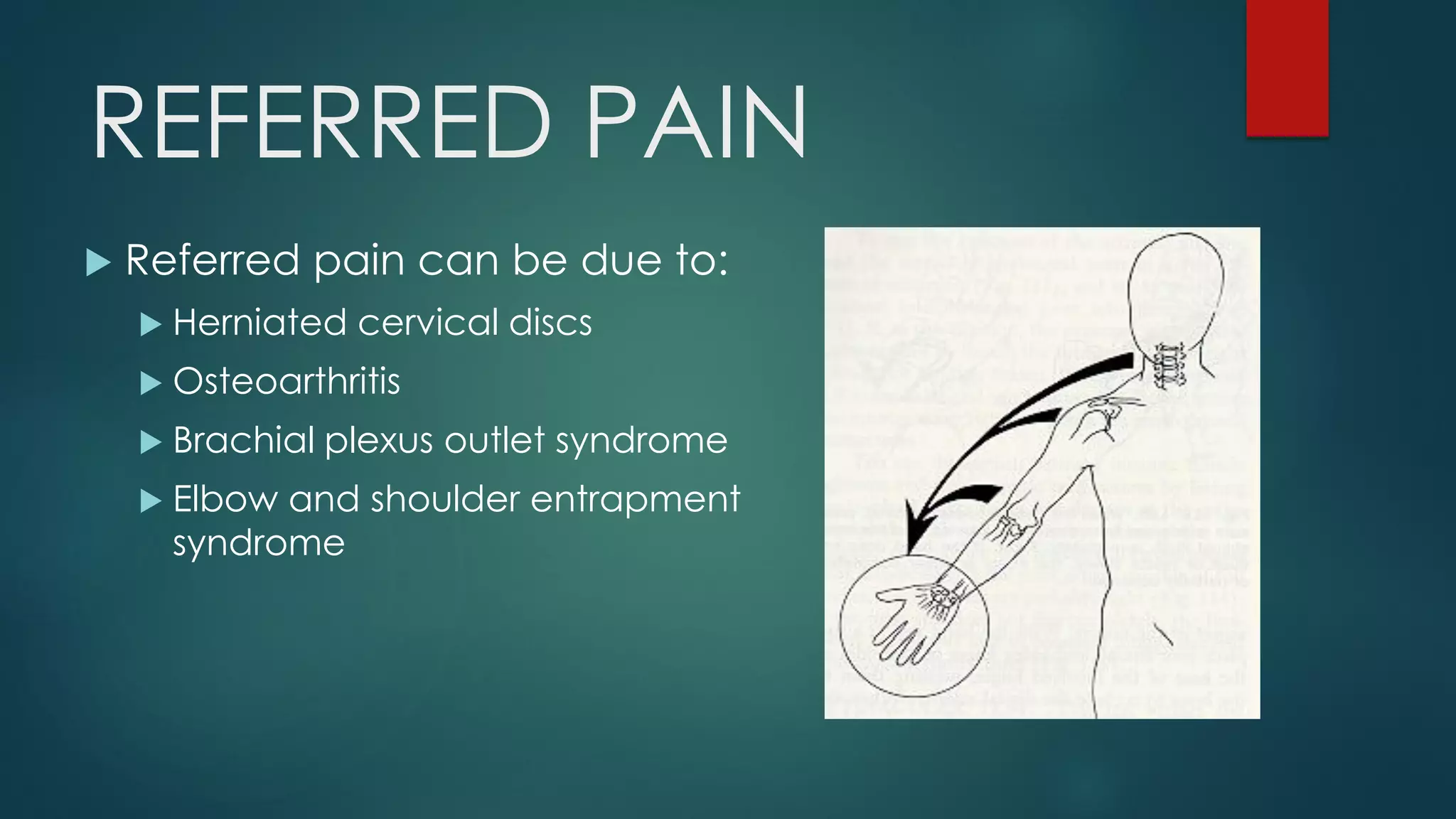REFERRED PAIN
 Referred pain can be due to:
 Herniated cervical discs
 Osteoarthritis
 Brachial plexus outlet syndrome
 Elbow and shoulder entrapment
syndrome
 