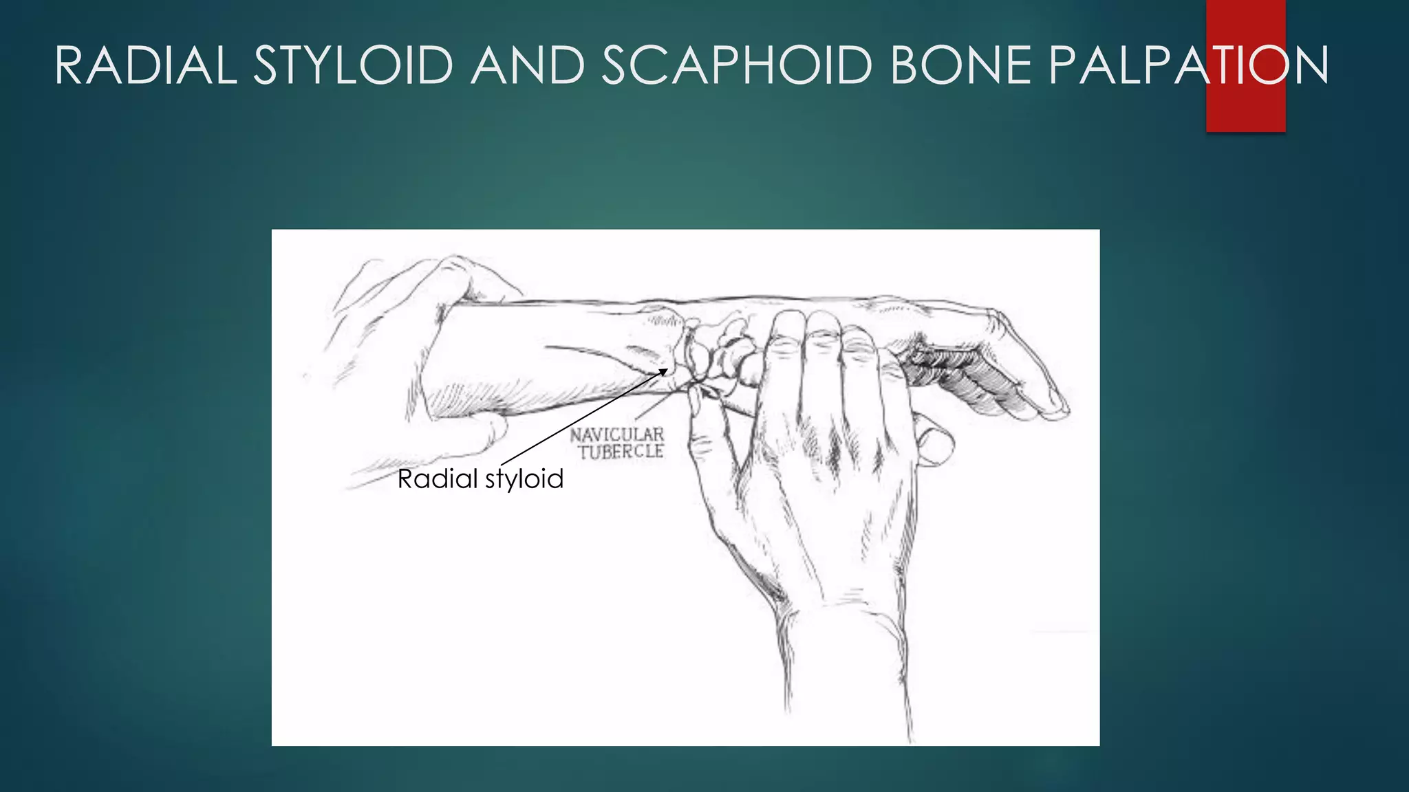 RADIAL STYLOID AND SCAPHOID BONE PALPATION
Radial styloid
 