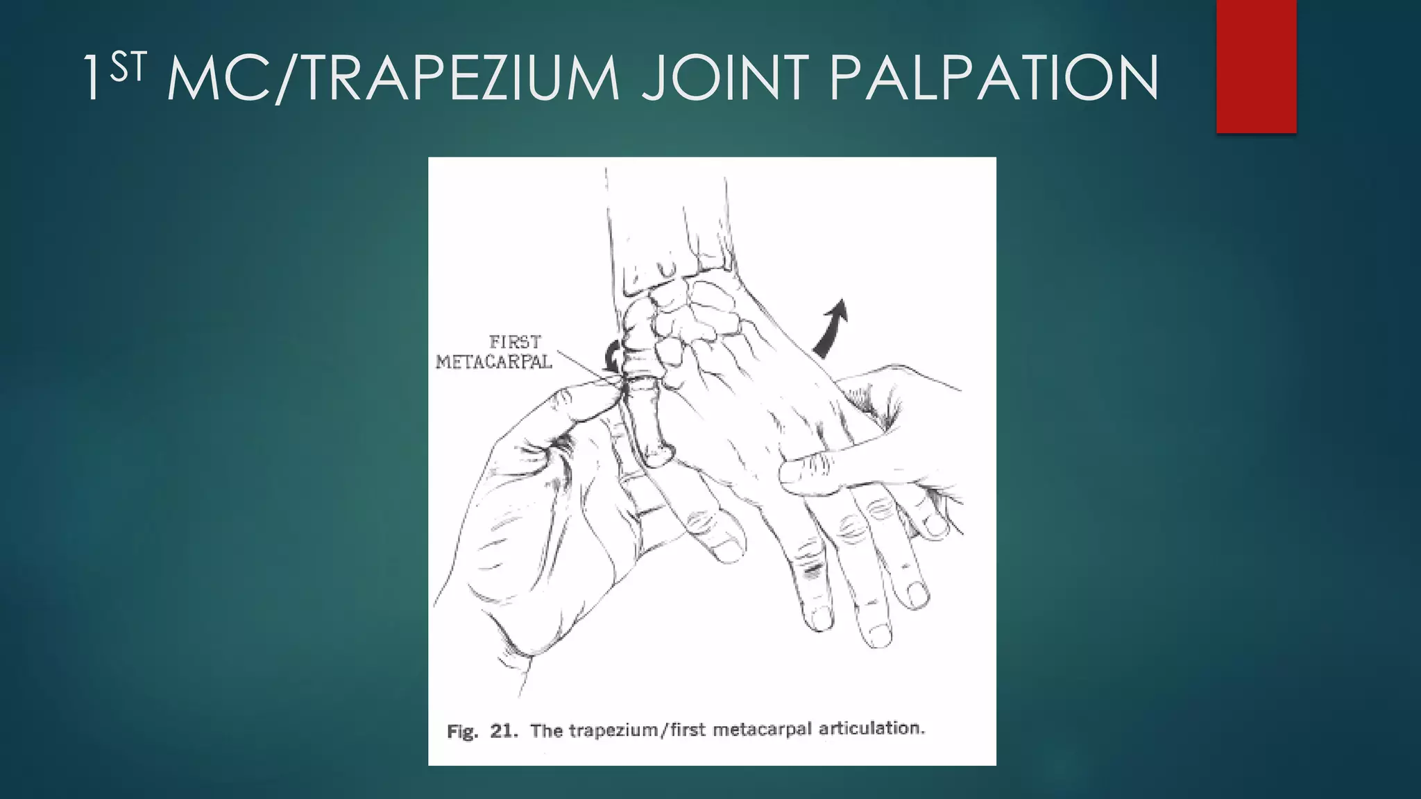 1ST MC/TRAPEZIUM JOINT PALPATION
 