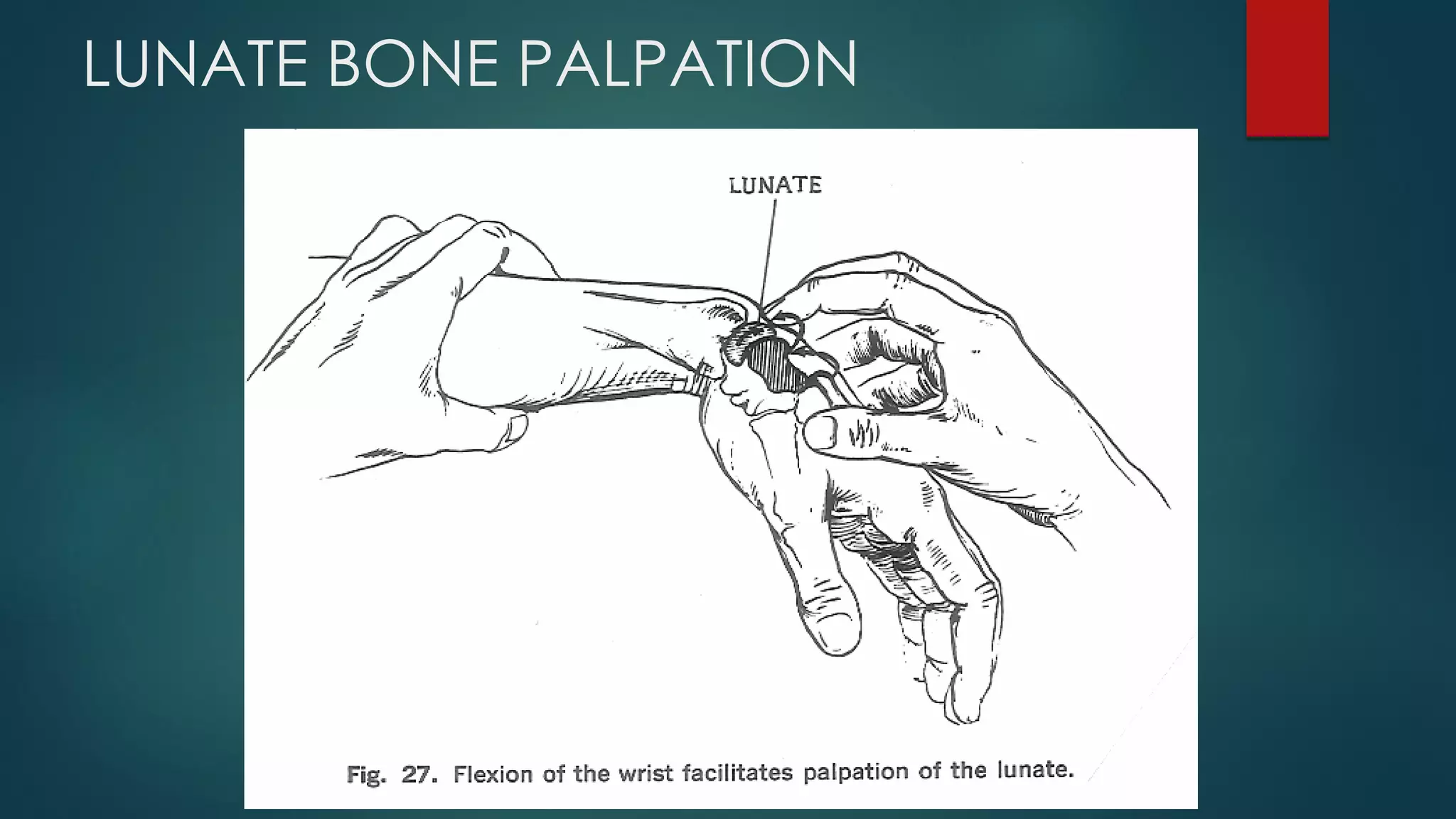 LUNATE BONE PALPATION
 