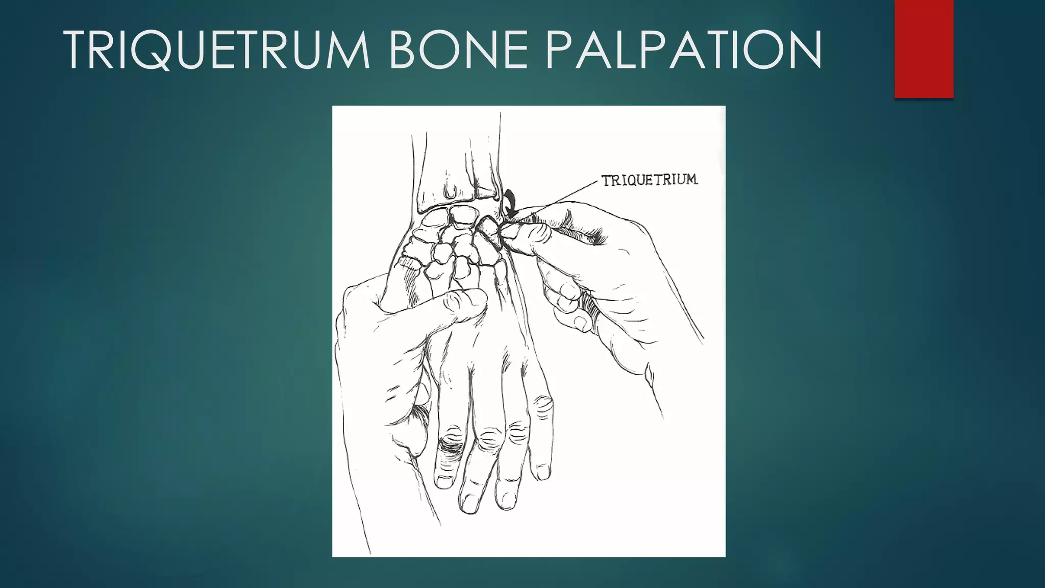 TRIQUETRUM BONE PALPATION
 
