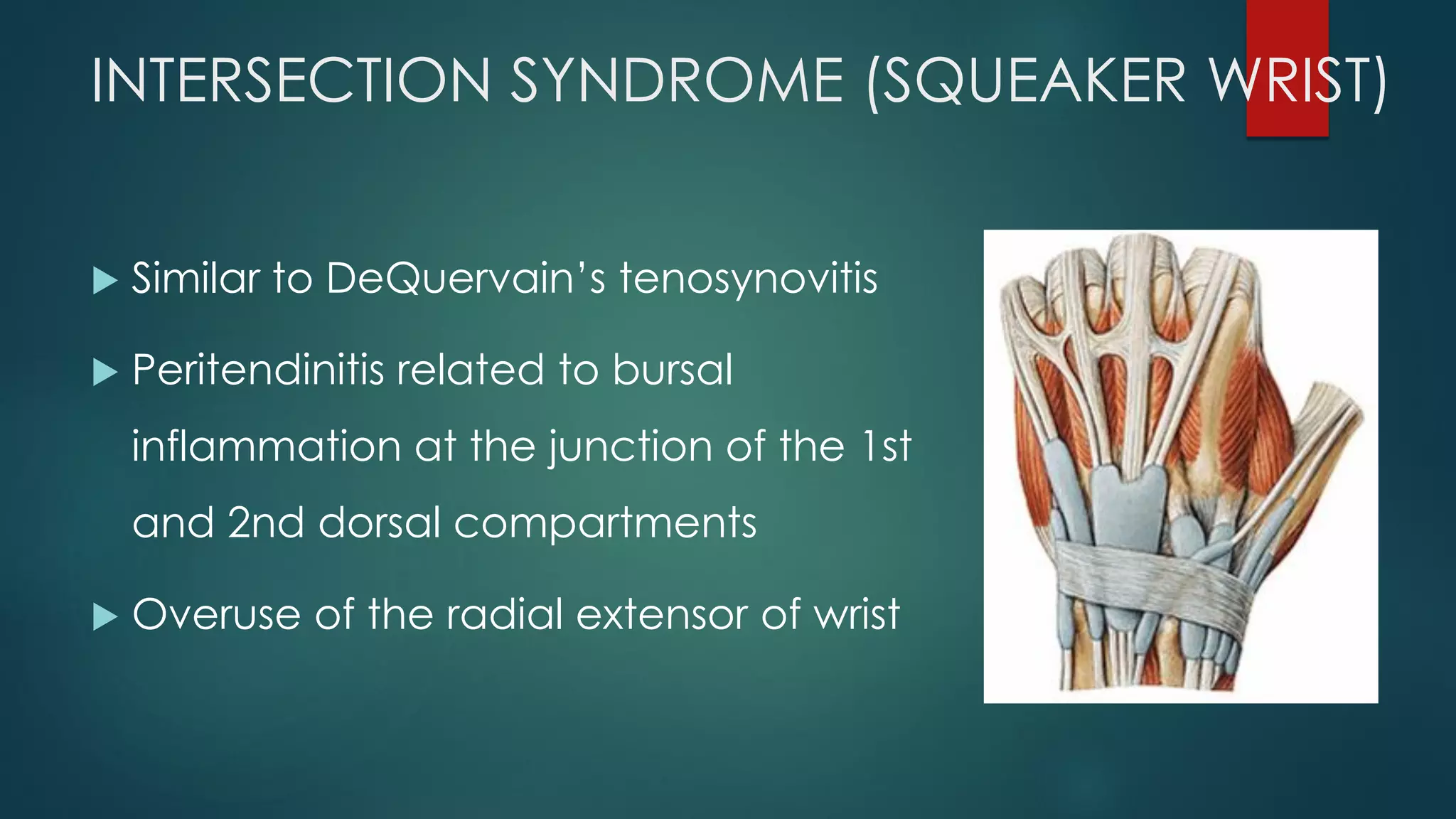 INTERSECTION SYNDROME (SQUEAKER WRIST)
 Similar to DeQuervain’s tenosynovitis
 Peritendinitis related to bursal
inflammation at the junction of the 1st
and 2nd dorsal compartments
 Overuse of the radial extensor of wrist
 