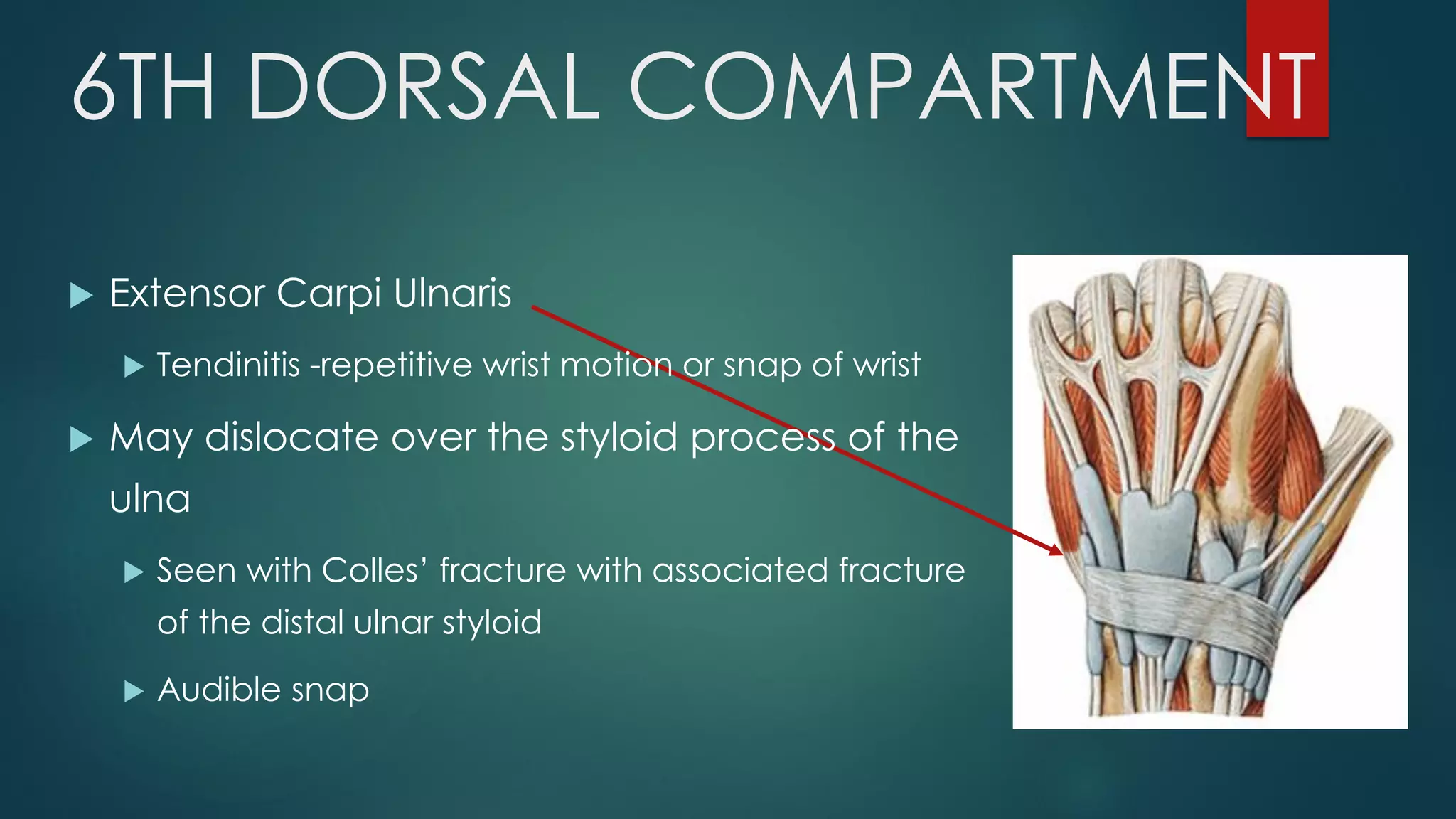 6TH DORSAL COMPARTMENT
 Extensor Carpi Ulnaris
 Tendinitis -repetitive wrist motion or snap of wrist
 May dislocate over the styloid process of the
ulna
 Seen with Colles’ fracture with associated fracture
of the distal ulnar styloid
 Audible snap
 