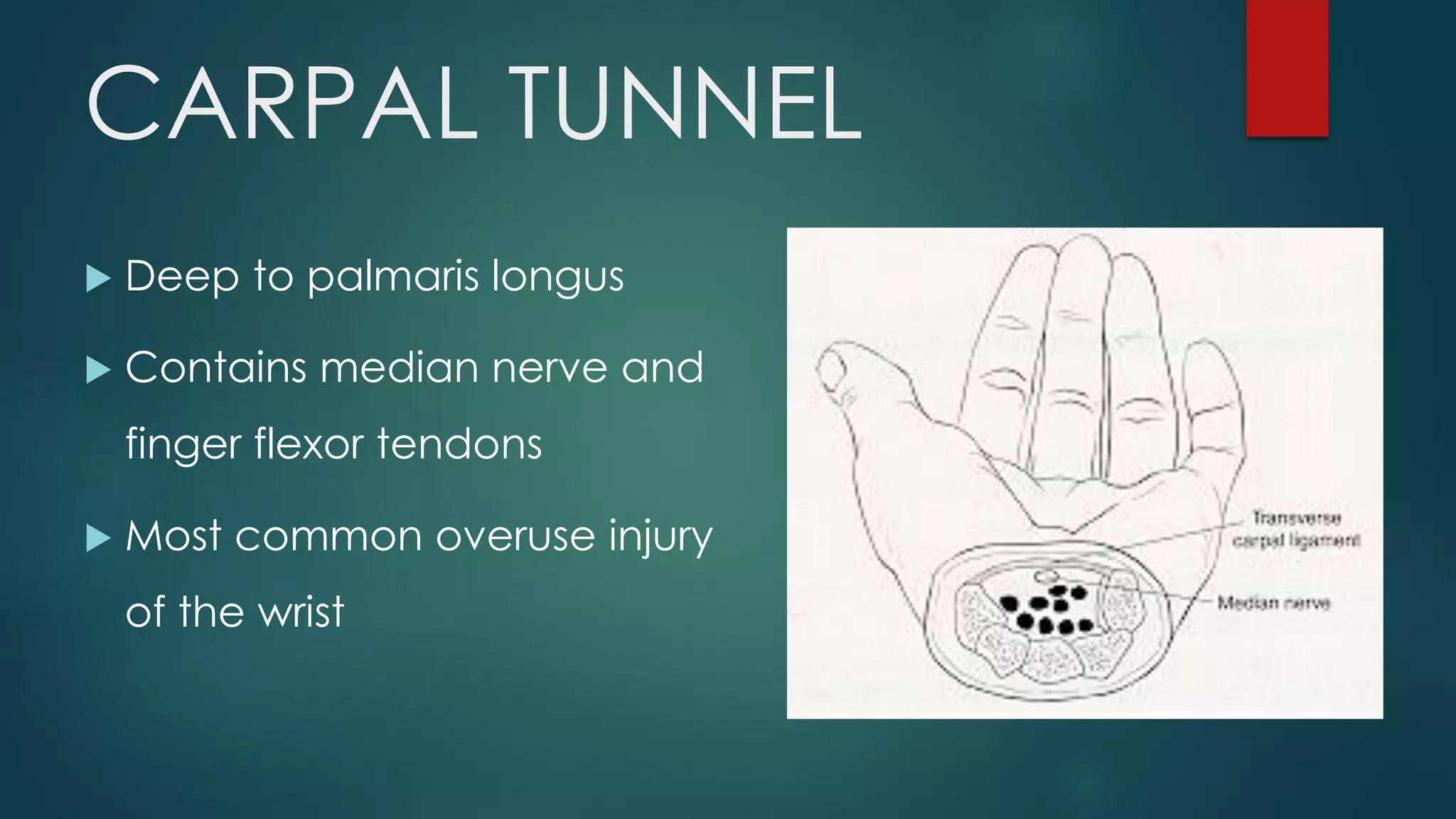 CARPAL TUNNEL
 Deep to palmaris longus
 Contains median nerve and
finger flexor tendons
 Most common overuse injury
of the wrist
 