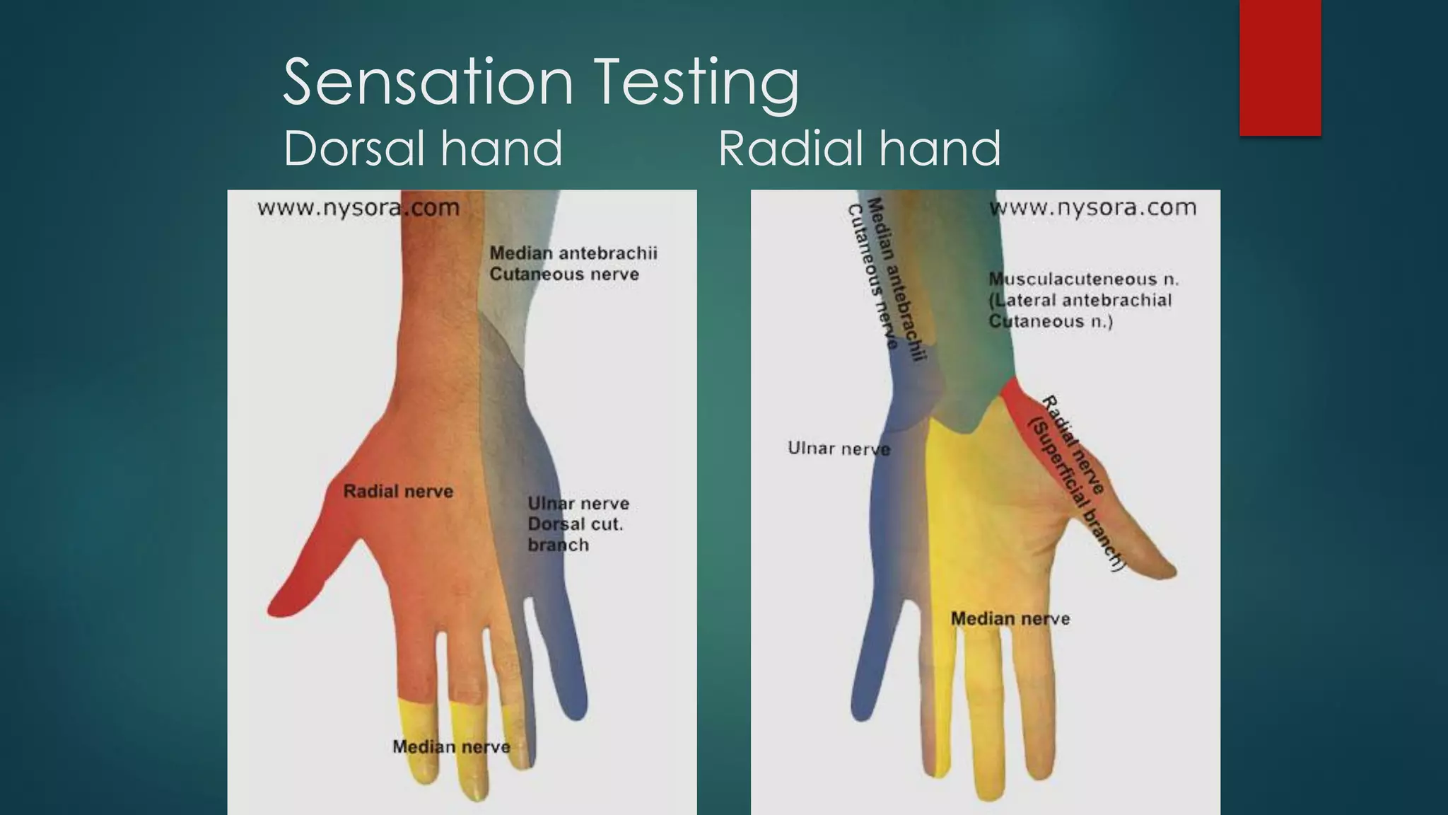 Sensation Testing
Dorsal hand Radial hand
 