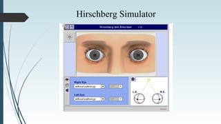 Hirschberg Simulator
 