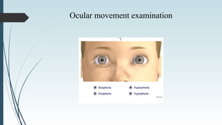 Ocular movement examination
 