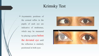 Krimsky Test
 Asymmetric positions of
the corneal reflex in the
pupils of each eye are
indicative of strabismus,
which may be measured
by placing a prism before
the deviated eye until
the reflection is similarly
positioned in both eyes
 