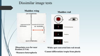 Dissimilar image tests
Maddox wing
Maddox rod
•Dissociates eyes for near
fixation (1/3 m)
•Measures heterophoria
•White spot converted into red streak
•Cannot differentiate tropia from phoria
 