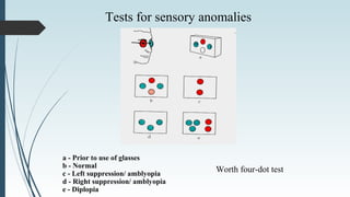 Tests for sensory anomalies
Worth four-dot test
a - Prior to use of glasses
b - Normal
c - Left suppression/ amblyopia
d - Right suppression/ amblyopia
e - Diplopia
 