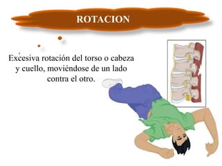Excesiva rotación del torso o cabeza
y cuello, moviéndose de un lado
contra el otro.
ROTACION
 