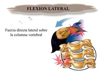 Fuerza directa lateral sobre
la columna vertebral
FLEXION LATERAL
 
