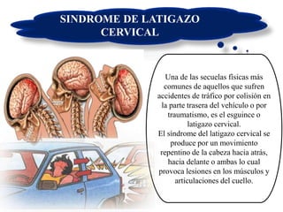 SINDROME DE LATIGAZO
CERVICAL
Una de las secuelas físicas más
comunes de aquellos que sufren
accidentes de tráfico por colisión en
la parte trasera del vehículo o por
traumatismo, es el esguince o
latigazo cervical.
El síndrome del latigazo cervical se
produce por un movimiento
repentino de la cabeza hacia atrás,
hacia delante o ambas lo cual
provoca lesiones en los músculos y
articulaciones del cuello.
 