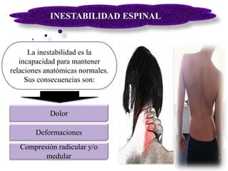 INESTABILIDAD ESPINAL
La inestabilidad es la
incapacidad para mantener
relaciones anatómicas normales.
Sus consecuencias son:
Dolor
Compresión radicular y/o
medular
Deformaciones
 