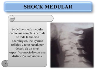 SHOCK MEDULAR
Se define shock medular
como una completa perdida
de toda la función
neurológica, incluyendo
reflejos y tono rectal, por
debajo de un nivel
especifico asociado con una
disfunción autonómica.
 