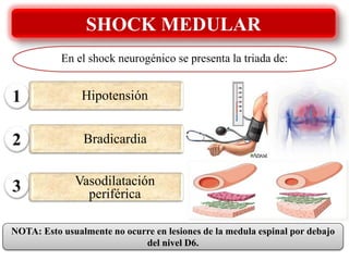SHOCK MEDULAR
En el shock neurogénico se presenta la triada de:
NOTA: Esto usualmente no ocurre en lesiones de la medula espinal por debajo
del nivel D6.
1
2
3
Bradicardia
Hipotensión
Vasodilatación
periférica
 