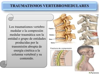 TRAUMATISMOS VERTEBROMEDULARES
Los traumatismos vertebro
medular o la compresión
medular traumática son la
entidad o grupo de entidades
producidas por la
transmisión abrupta de
energía cinética a la
columna vertebral y su
contenido.
 