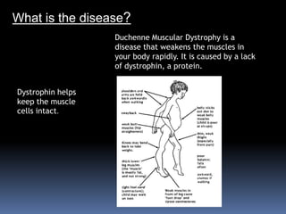 What is the disease?Duchenne Muscular Dystrophy is a disease that weakens the muscles in your body rapidly. It is caused by a lack of dystrophin, a protein. Dystrophin helps keep the muscle cells intact.