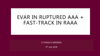 EVAR IN RUPTURED AAA +
FAST-TRACK IN RAAA
F2 PARACH SIRISRIRO
9th July 2018
 