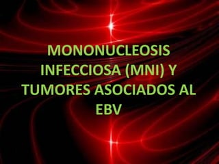 MONONUCLEOSIS
  INFECCIOSA (MNI) Y
TUMORES ASOCIADOS AL
         EBV

          Axel Fernando Castillo Cruz
 