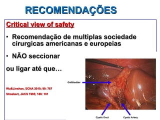 RECOMENDAÇÕES Critical view of safety Recomendação de multiplas sociedade cirurgicas americanas e europeias NÃO seccionar ou ligar até que… Wu&Linehan, SCNA 2010; 90: 787 Strasbert, JACS 1995; 180: 101 