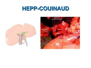 HEPP-COUINAUD 
