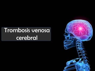 Trombosis venosa
cerebral

 