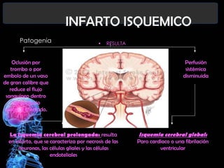 INFARTO ISQUEMICO
Patogenia

•

RESULTA

Oclusión por
trombo o por
embolo de un vaso
de gran calibre que
reduce el flujo
sanguíneo dentro
del territorio
vascular afectado.

La isquemia cerebral prolongada: resulta
en infarto, que se caracteriza por necrosis de las
neuronas, las células gliales y las células
endoteliales

Perfusión
sistémica
disminuida

Isquemia cerebral global:

Paro cardiaco o una fibrilación
ventricular

 