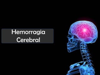 Hemorragia
Cerebral

 