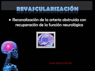 Stroke 2005;36.280-290

 