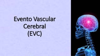 Evento Vascular
Cerebral
(EVC)
 