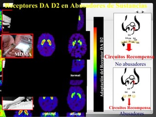 Adaptación del Receptor DA D2  Cocaina Alcohol DA DA DA DA DA   DA   DA Circuitos Recompensa DA   DA   DA   DA   DA   Circuitos Recompensa DA DA DA DA DA   DA Abusadores No abusadores Heroina MDMA Receptores DA D2 en Abusadores de Sustancias control adicto 