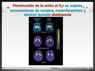 Disminución de la unión al D 2 r   en sujetos consumidores de cocaína, metanfetaminas y alcohol durante   abstinencia Goldstein R., American Journal of Psychiatry. 2002 