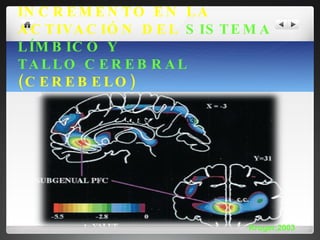 INCREMENTO EN LA ACTIVACIÓN DEL  SISTEMA LÍMBICO Y  TALLO CEREBRAL  (CEREBELO) Kruger y cols. 2003 Kruger,2003 