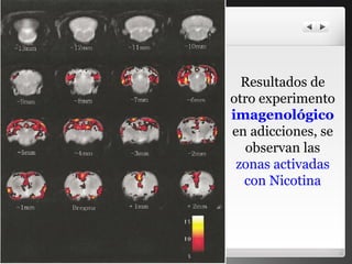 Resultados de otro experimento  imagenológico  en adicciones, se observan las  zonas activadas con Nicotina 