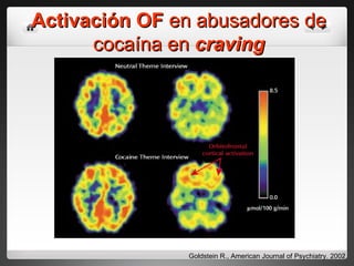 Activación OF  en abusadores de cocaína en  craving Goldstein R., American Journal of Psychiatry. 2002 